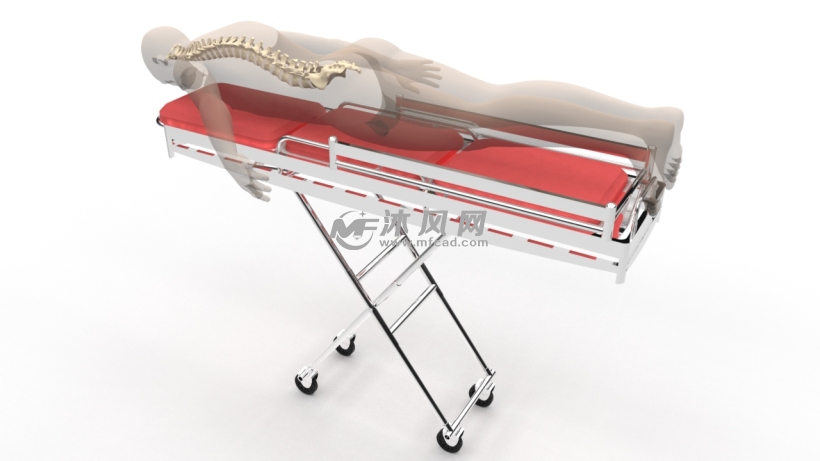 医疗器械脊柱固定器 - solidworks机械设备模型