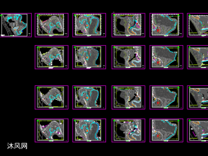 山体公园绿化施工图